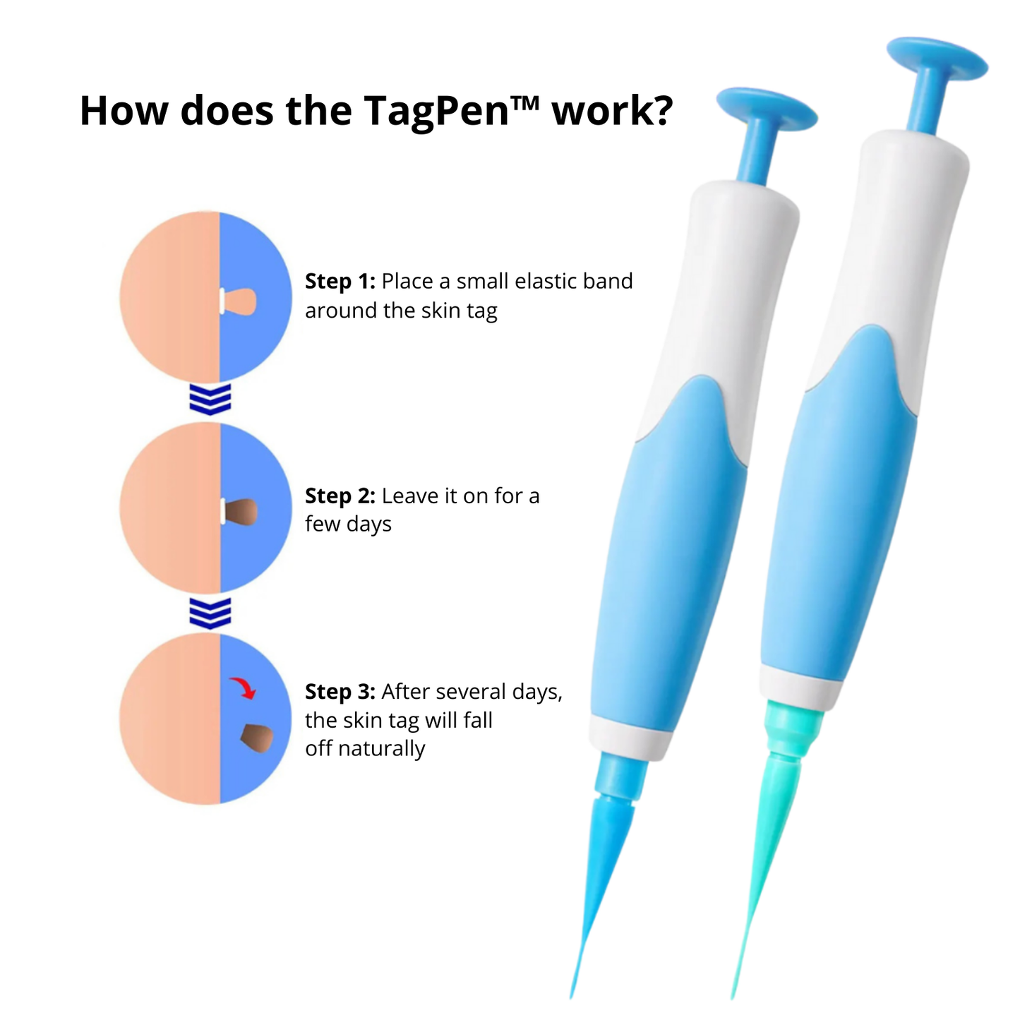 Lush TagPen Kit™ | Remove skin tags easily at home