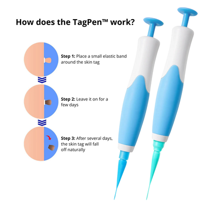 Lush TagPen Kit™  | Remove skin tags easily at home