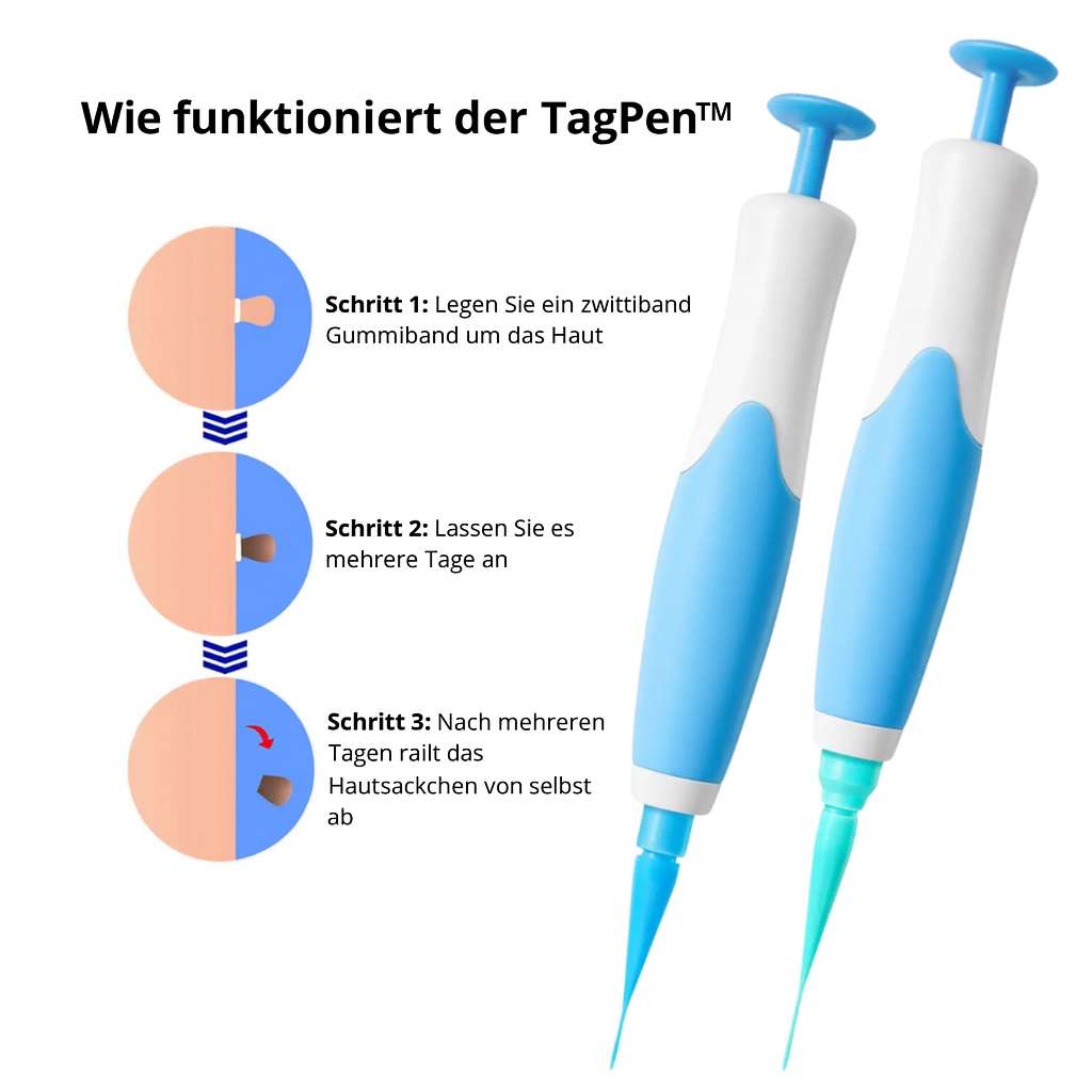 Lush TagPen Kit™ | Hautanhängsel einfach zu Hause entfernen