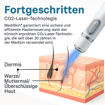 Lush MediSkin Laser | Sanft Zu Perfektion
