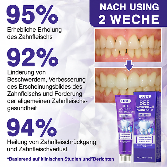Lush | Bee Venom Zahnpasta