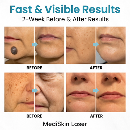 Lush MediSkin Laser