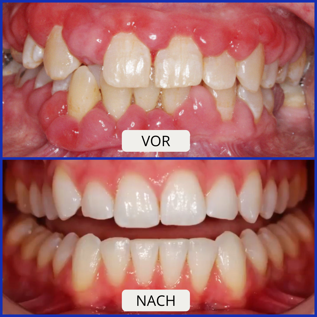 Lush | Bee Venom Zahnpasta